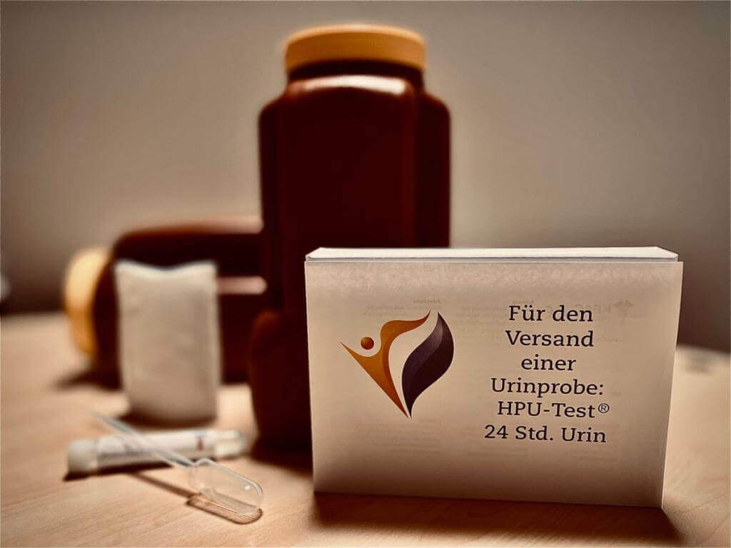 Labordiagnostik für einen HPU/KPU-Test: Urinprobe zur Feststellung einer Stoffwechselstörung.