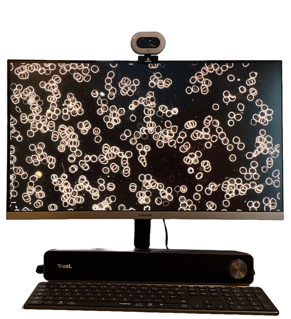 Live-Analyse von Vitalblut am Monitor während der Dunkelfelddiagnostik

