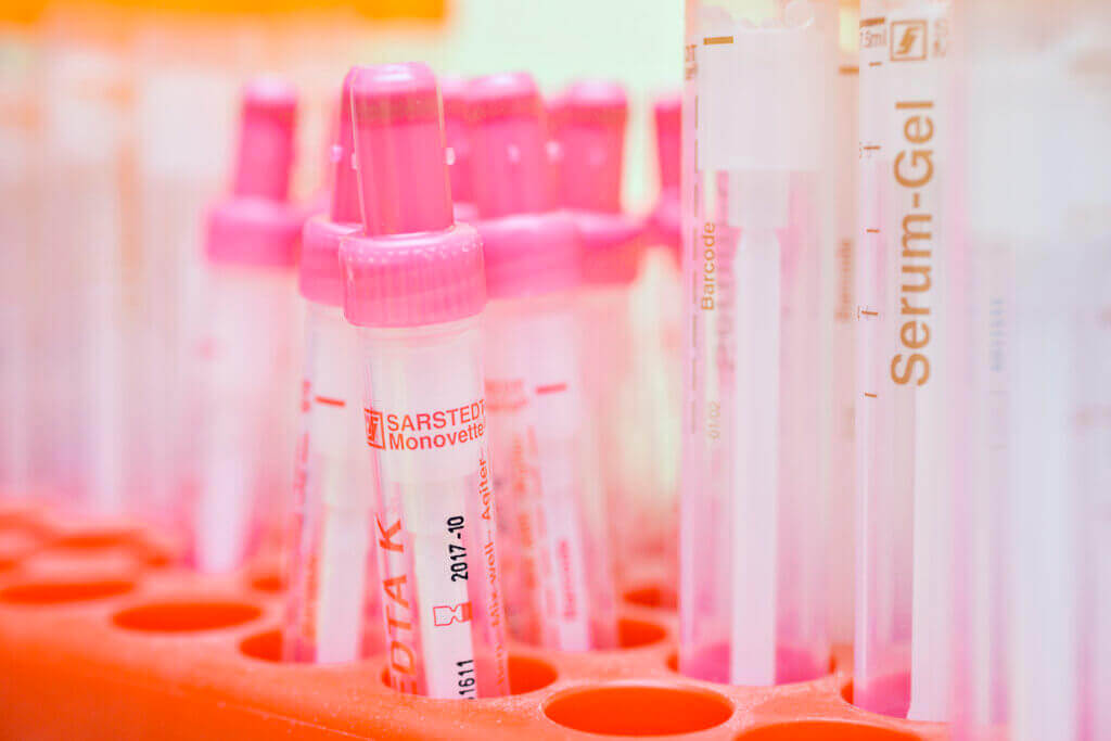 Monovetten zur Blutabnahme für die naturheilkundliche Labordiagnostik.